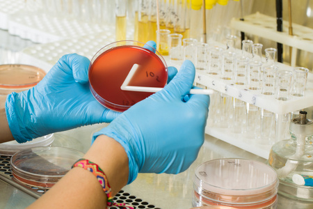 Triple Sugar Iron Agar (TSI): Reliable Culture Media for Microbiology Laboratories