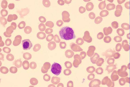 Influenza A/B Antigen Rapid Test: Efficient Seasonal Flu Screening | BABIO